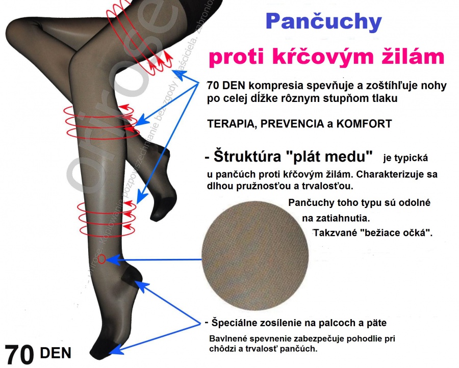 Exkluzívne pančuchy proti krčovým žilám so stupňovaným stiskom mmHg18/22 hPa24/29